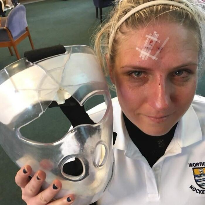 20 Pessoas que puderam contar com a sorte e foram poupadas de situações péssimas